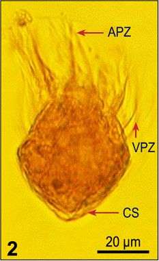 Imagem de Strombidium acutum Leegaard 1915