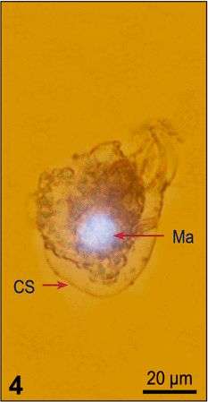 Слика од Strombidium acutum Leegaard 1915