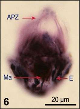 Слика од Strombidium acutum Leegaard 1915