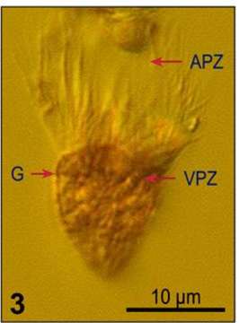 Image of Strombidium epidemum Lynn, Montagnes & Small 1988