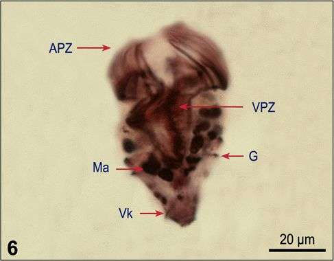 Image of Strombidium lynni Martin & Montagnes 1993