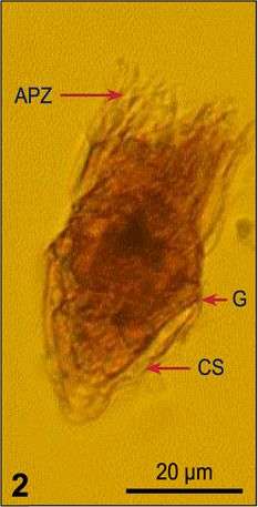 Imagem de Strombidium wulffi Kahl 1932