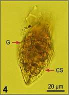 Imagem de Strombidium wulffi Kahl 1932