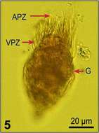 Imagem de Strombidium wulffi Kahl 1932