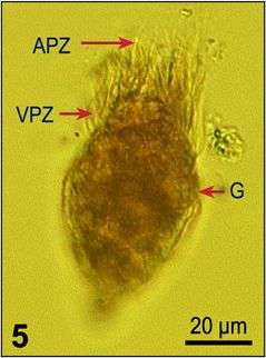 Image of Strombidium wulffi Kahl 1932