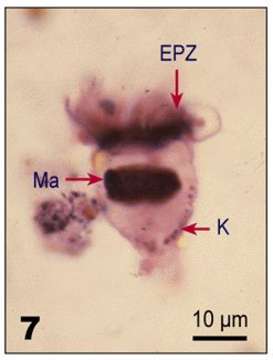 Imagem de Lohmanniella oviformis Leegaard 1915