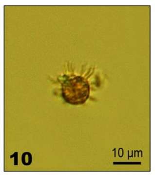 Image of Lohmanniella oviformis Leegaard 1915