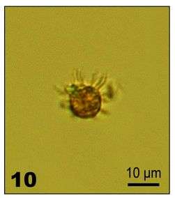 Imagem de Lohmanniella oviformis Leegaard 1915