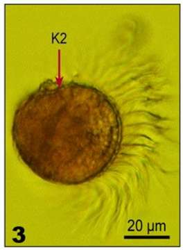 Imagem de Pelagostrobilidium Petz, Song & Wilbert 1995