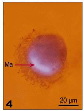 Imagem de Pelagostrobilidium Petz, Song & Wilbert 1995