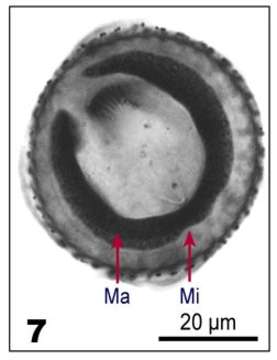 Imagem de Pelagostrobilidium Petz, Song & Wilbert 1995