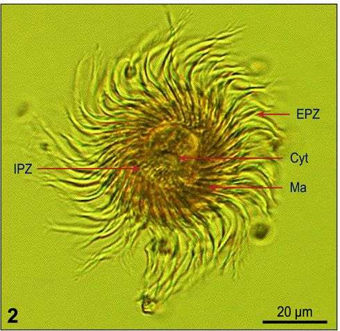 Image of Lohmanniella spiralis Leegaard 1915