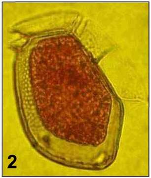 Image of Dinophysis Ehrenberg 1839
