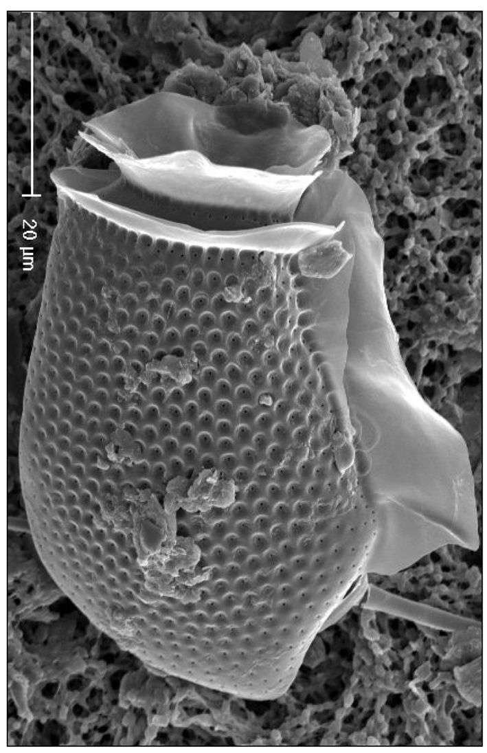 Слика од Dinophysis acuta