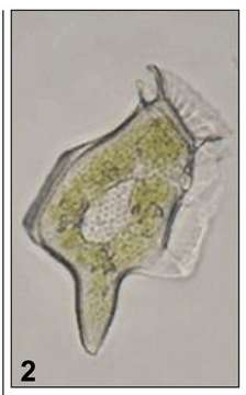 Image of dinoflagellates