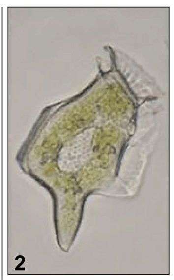 Image of dinoflagellates