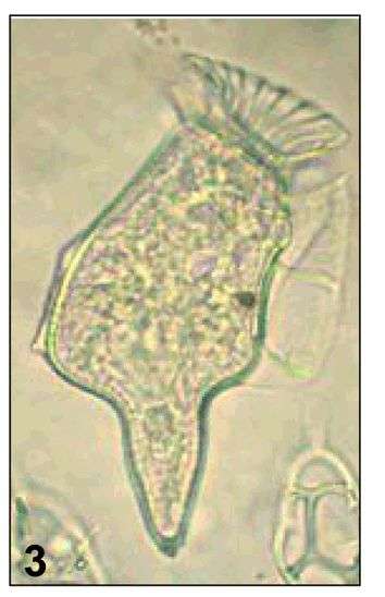 Dinoflagellata resmi