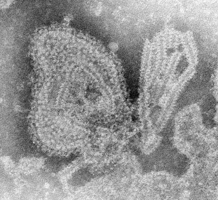 Слика од Mumps rubulavirus