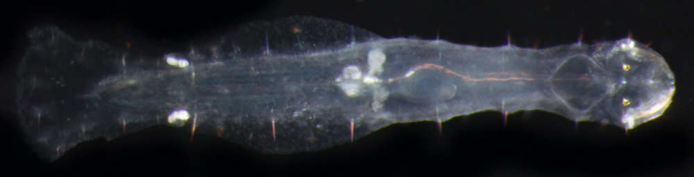 Image of Spadellidae Tokioka 1965