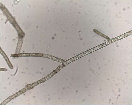 Image of Cladophora socialis