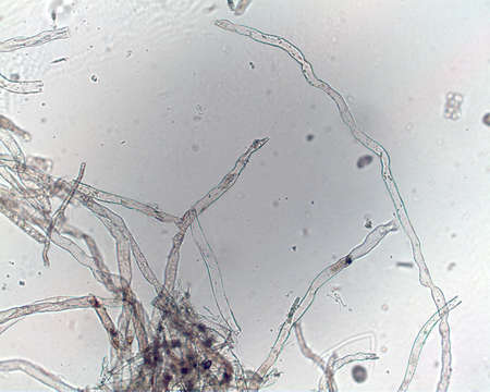 Image of Dichotomosiphonaceae