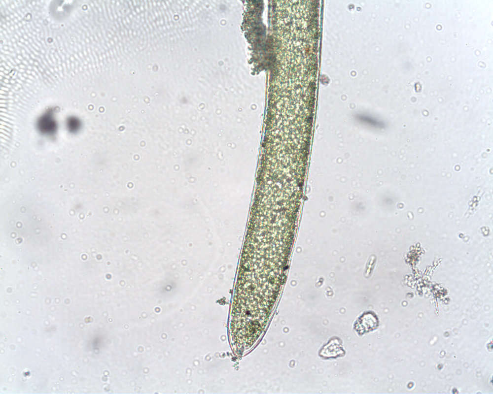 Image of Cladophoraceae