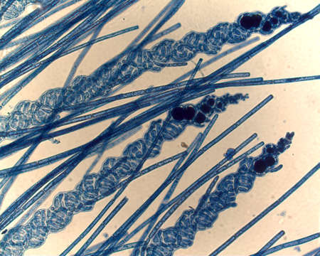 Image de Spirocladia Børgesen 1933