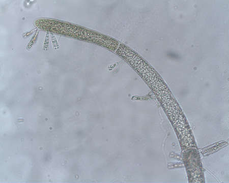 Image of Cladophora prehendens Kraft & A. J. K. Millar 2000