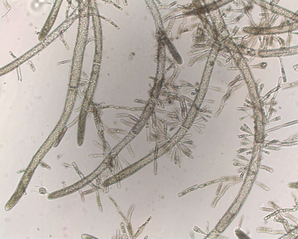 Image of Cladophora prehendens Kraft & A. J. K. Millar 2000