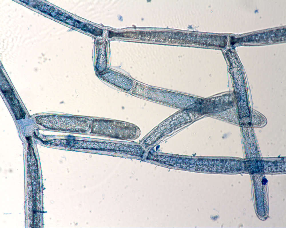 Image of <i>Cladophora socialis cf</i>