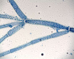 Image of <i>Cladophora socialis cf</i>
