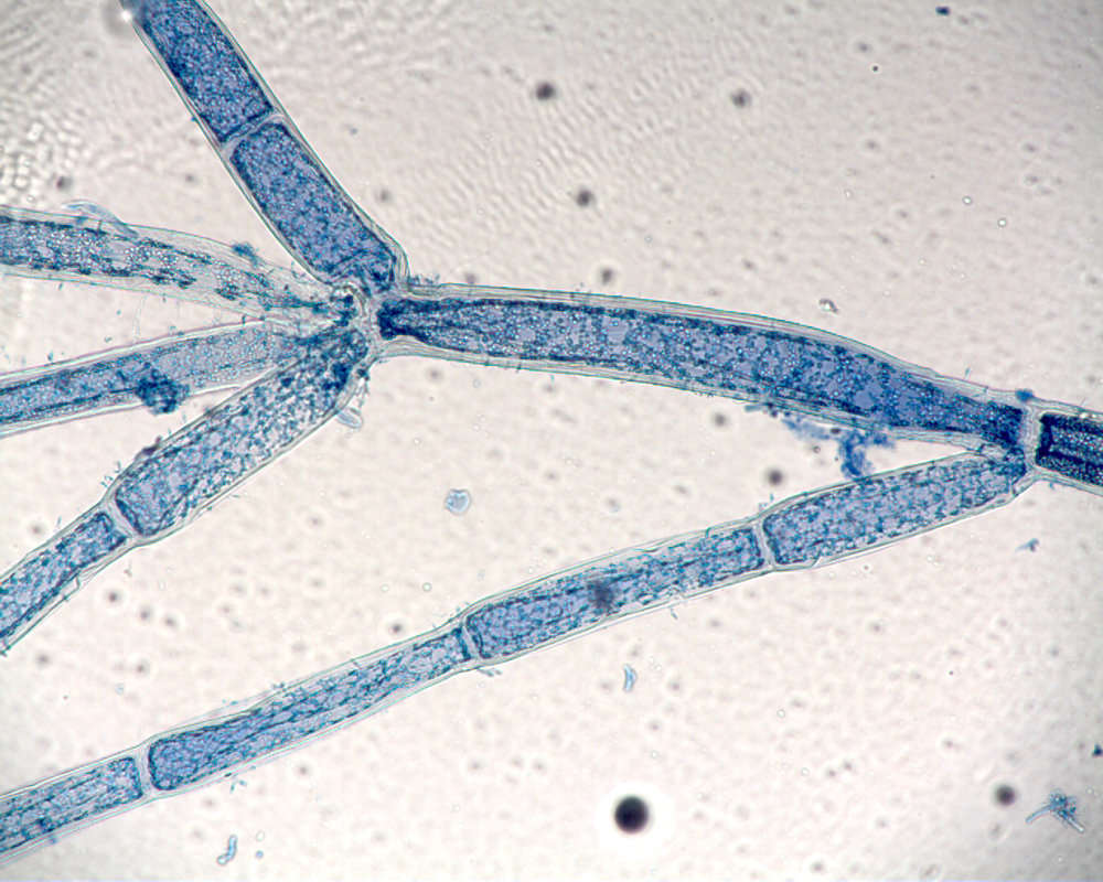 Image of <i>Cladophora socialis cf</i>