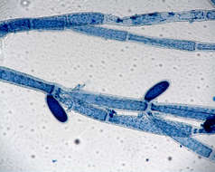 Image of <i>Cladophora socialis cf</i>