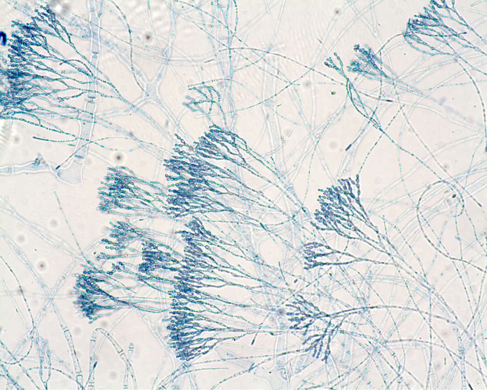 Image of Peleophycus multiprocarpium
