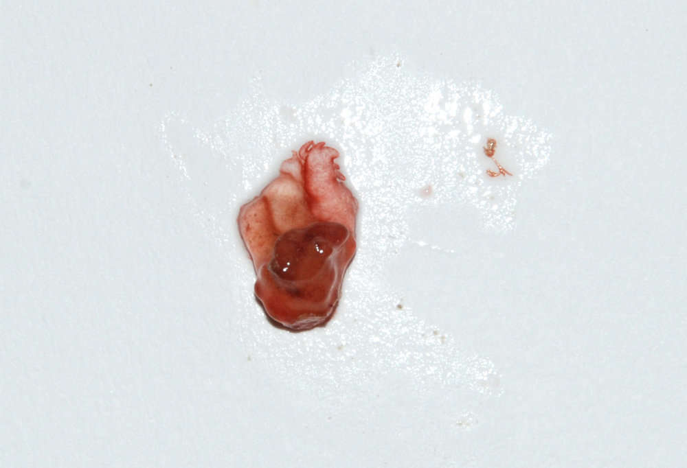 Image of Peleophycus multiprocarpium