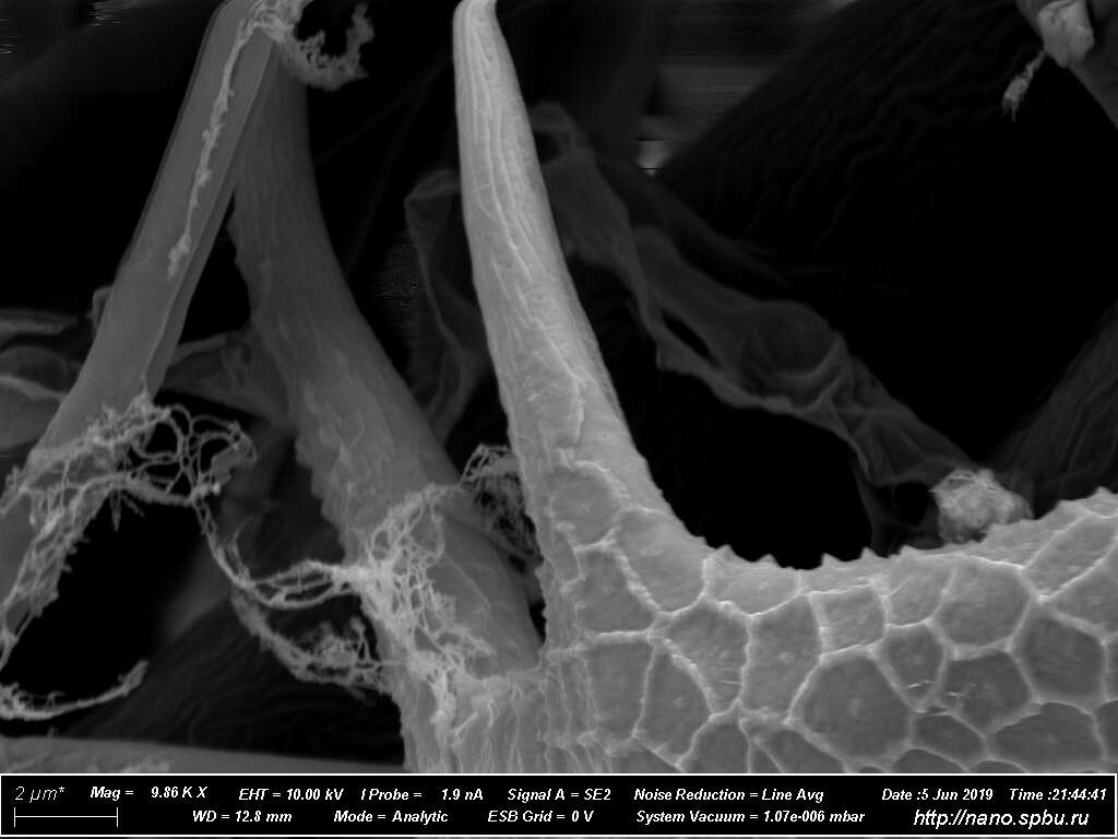 Image de Keratella cochlearis (Gosse 1851)