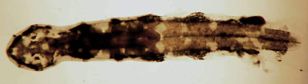 Image of arrow worms