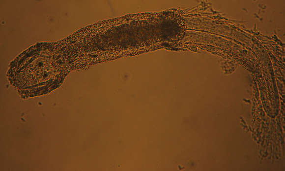 Image of arrow worms