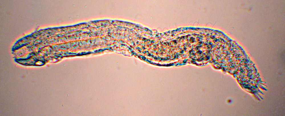 Image of gastrotrichs