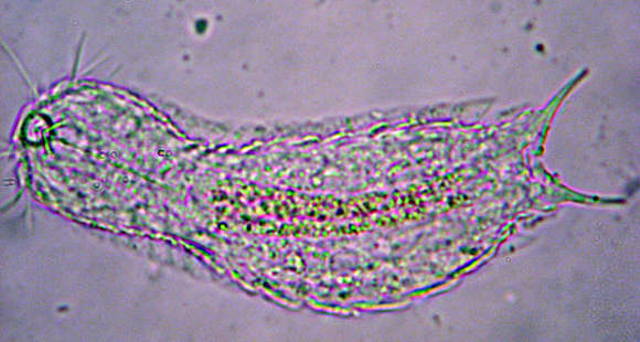 Image of gastrotrichs