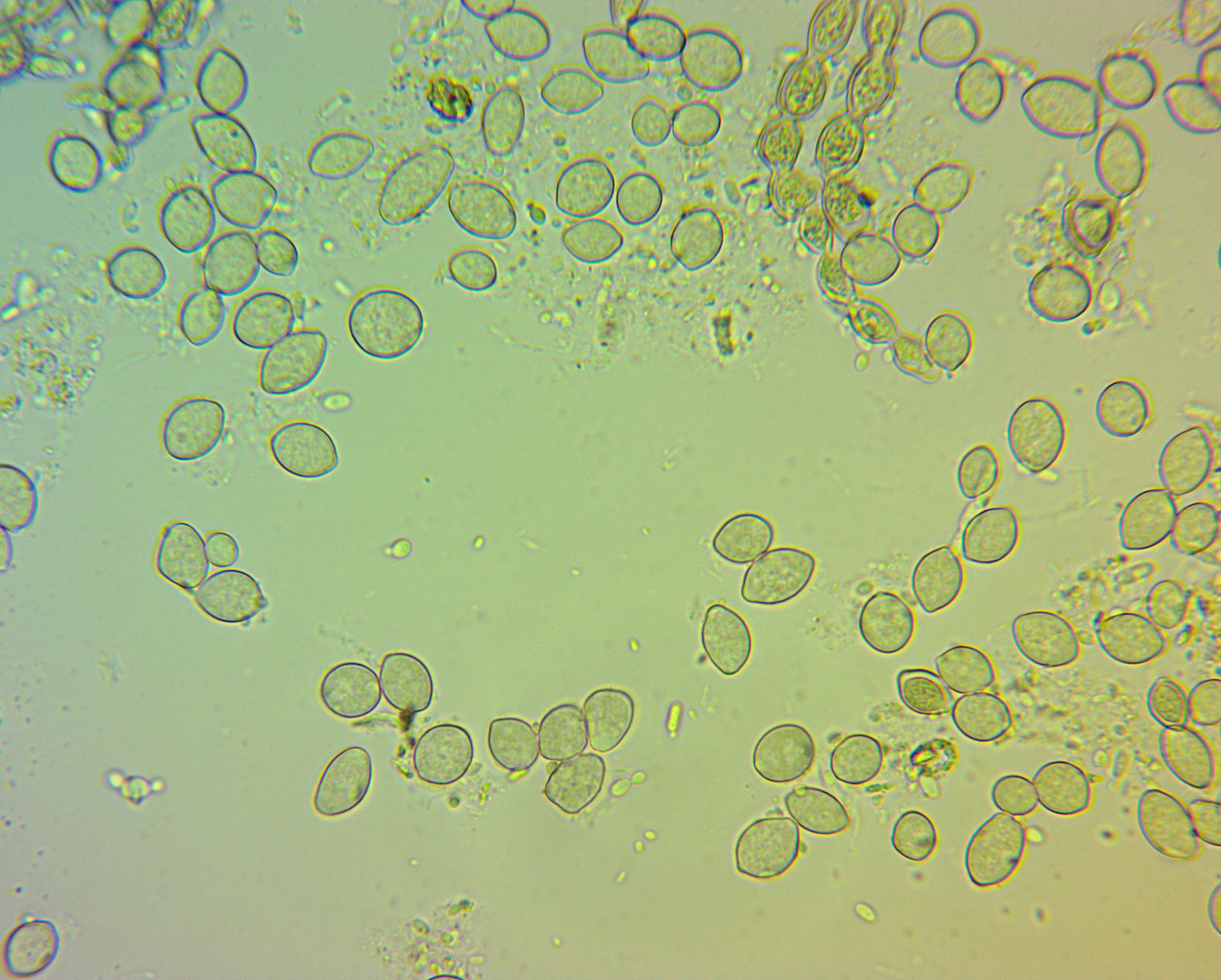 Image of Monilinia fructicola (G. Winter) Honey 1928