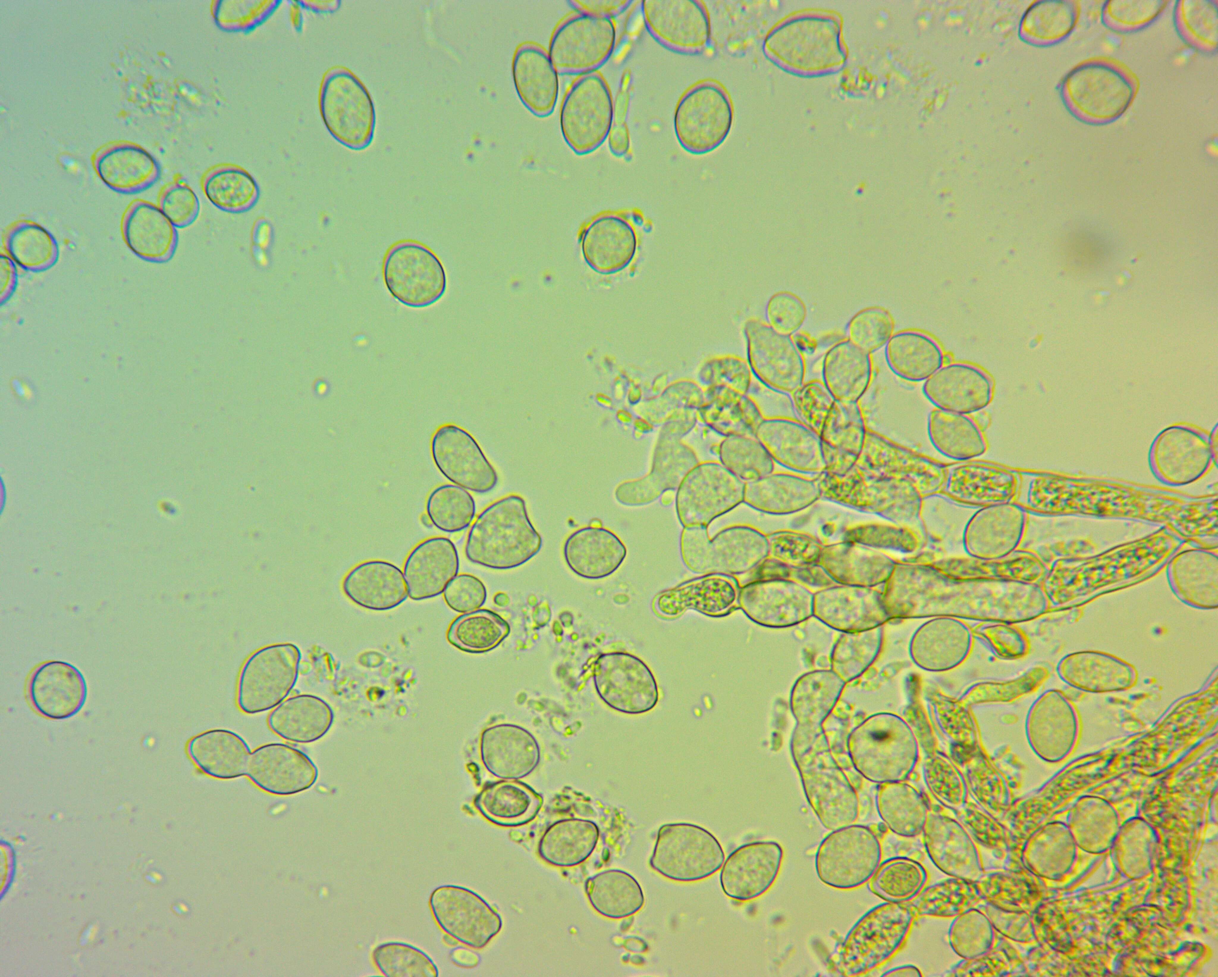 Image of Monilinia fructicola (G. Winter) Honey 1928