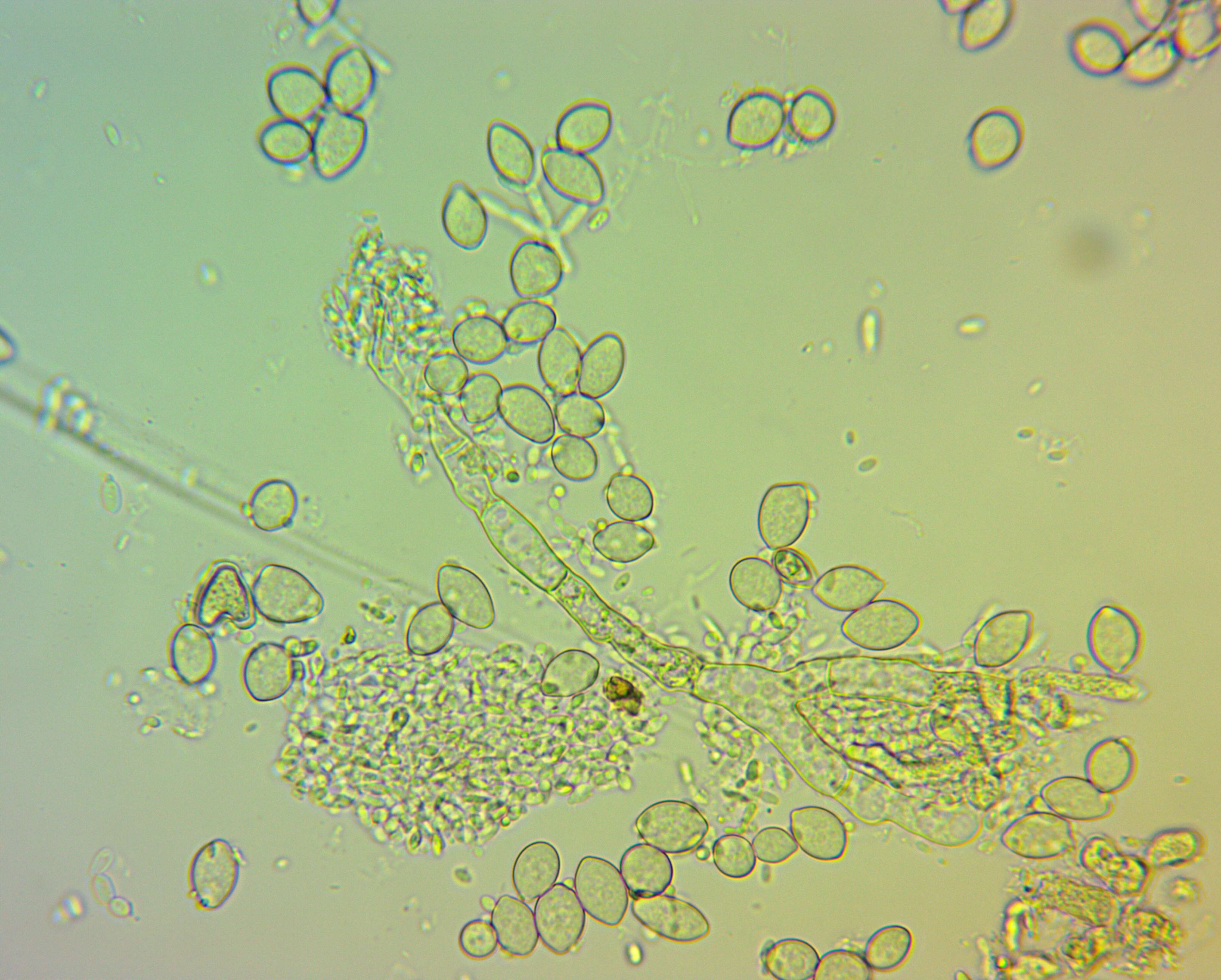 Image of Monilinia fructicola (G. Winter) Honey 1928