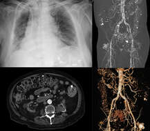 Imagem de Dialysis