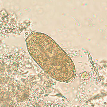 Image of Capillaria philippinensis