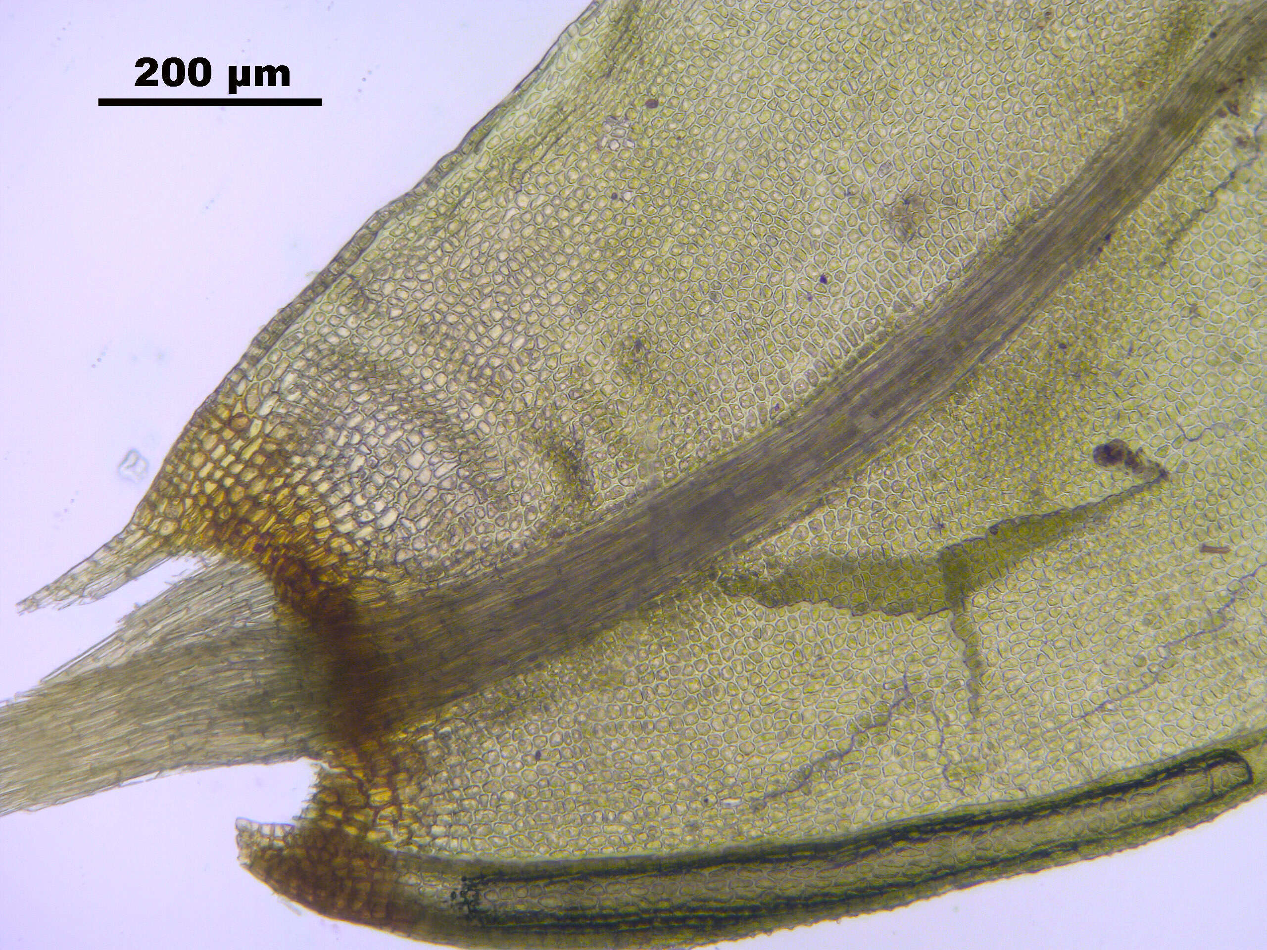 Image of turgid aulacomnium moss