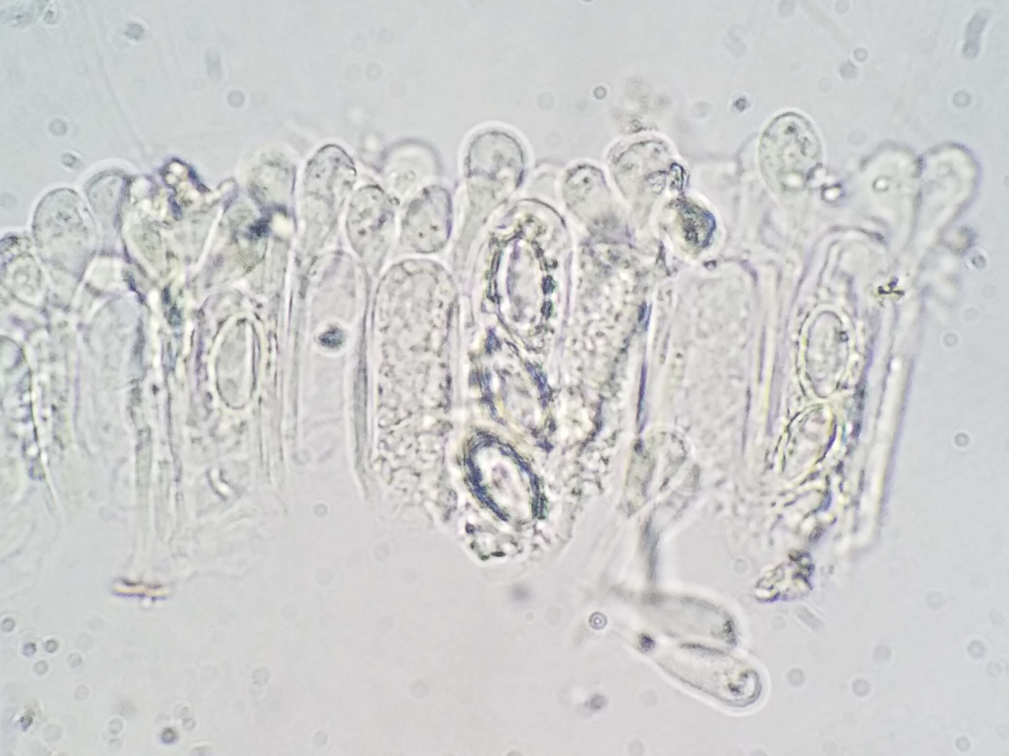 Image of Melastiza cornubiensis (Berk. & Broome) J. Moravec 1992