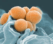 Image of Streptococcus pyogenes