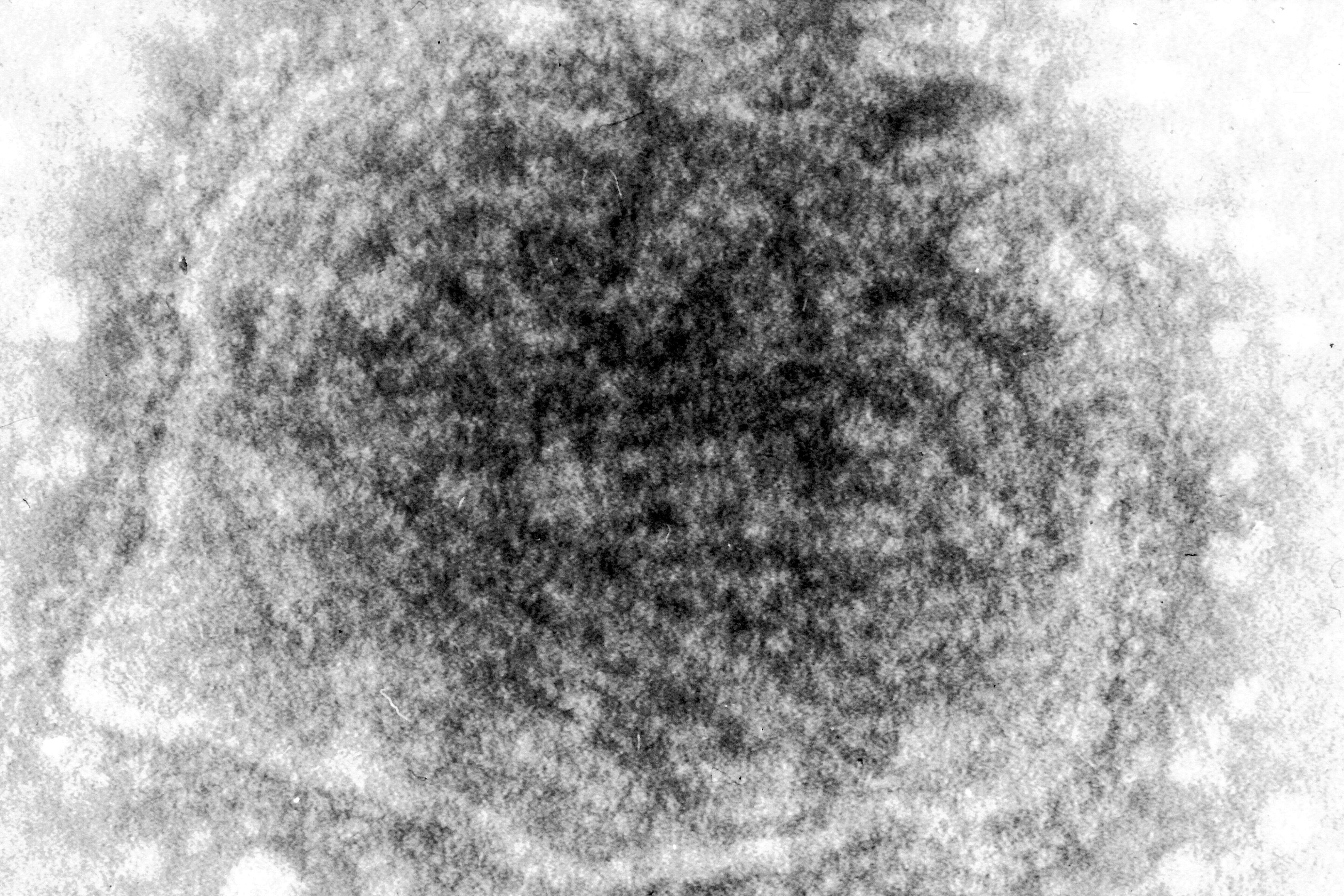 Image de Mumps rubulavirus