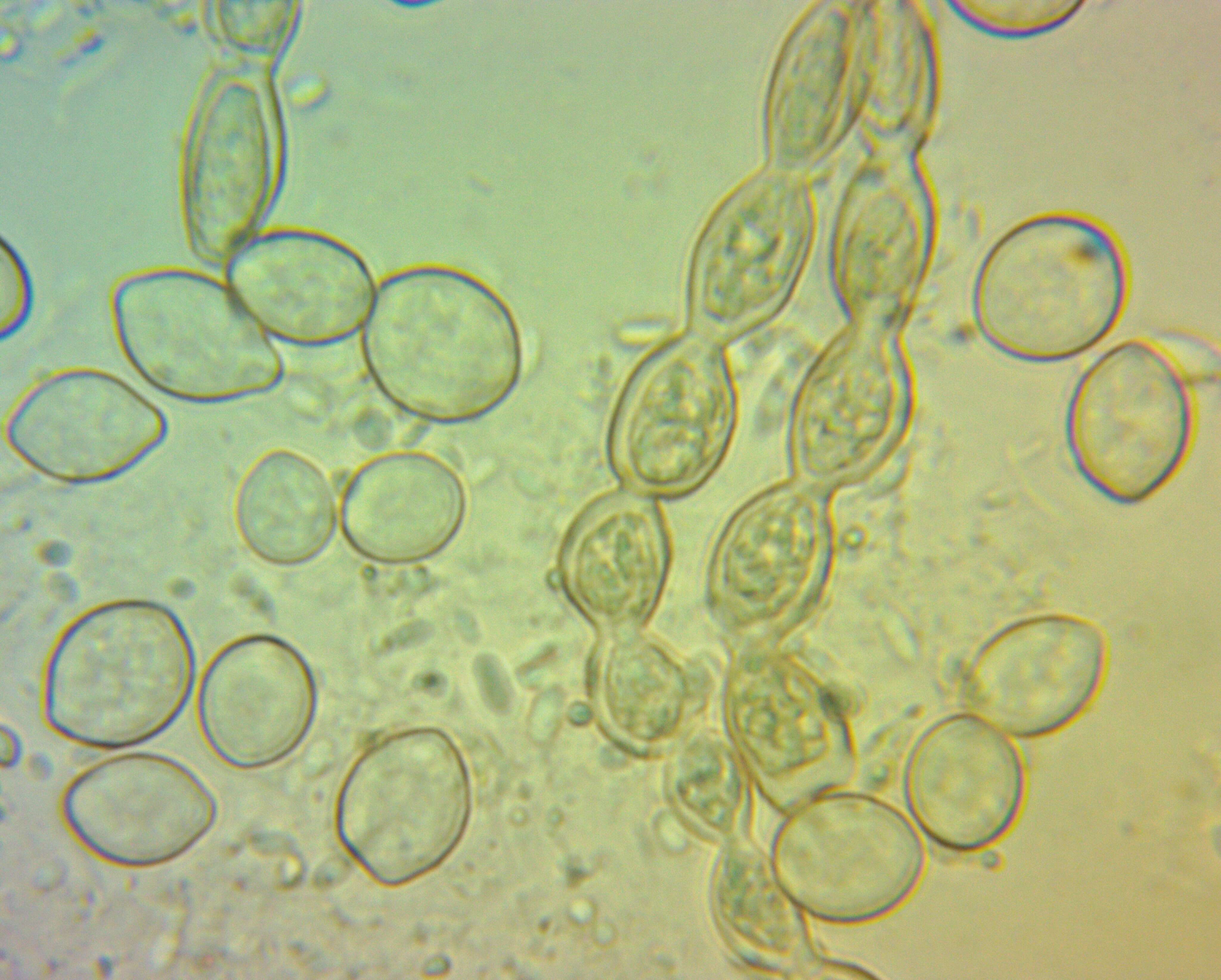 Image of Monilinia fructicola (G. Winter) Honey 1928